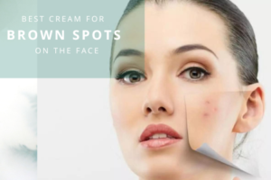 Choosing the Right Cream for Brown Spots: Check this guide!